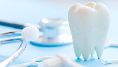 استشارة تجميل الأسنان